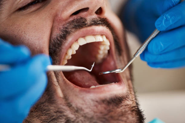 Full Mouth Reconstruction in Brewton, AL